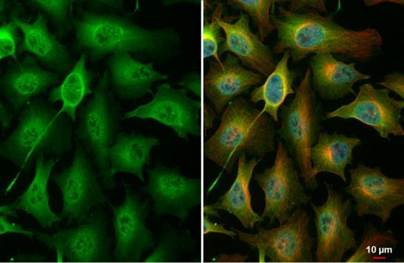 Phospho-PKC zeta (Thr410) Antibody in Immunocytochemistry (ICC/IF)