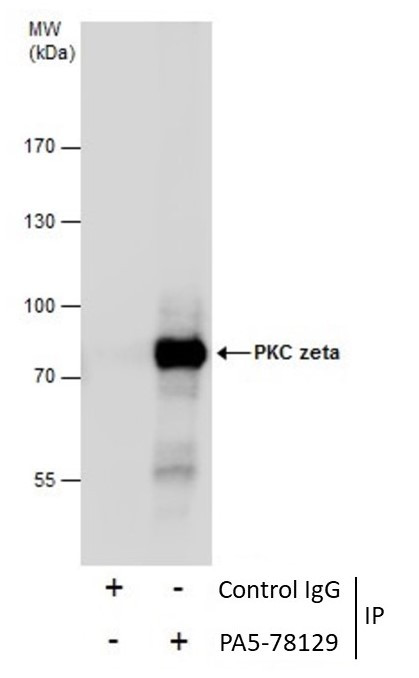 PKC zeta Polyclonal Antibody