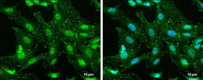 Phospho-FAK (Tyr576) Antibody in Immunocytochemistry (ICC/IF)