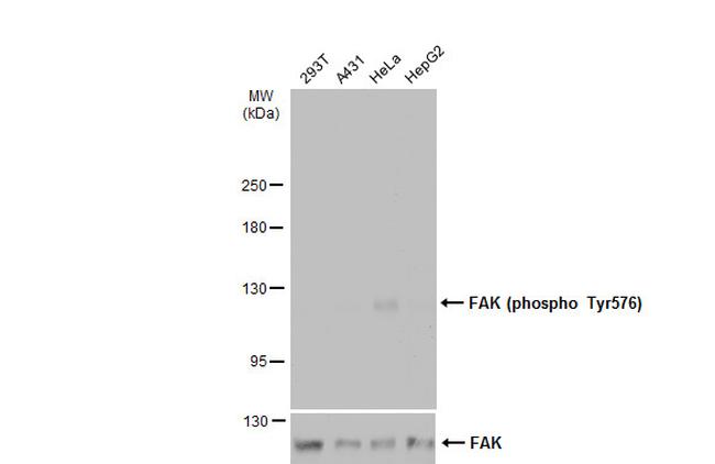 Phospho-FAK (Tyr576) Antibody in Western Blot (WB)