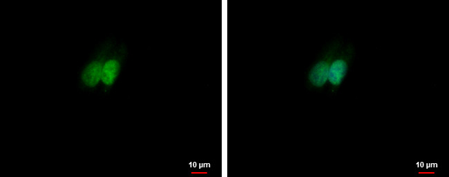 RXRA Antibody in Immunocytochemistry (ICC/IF)