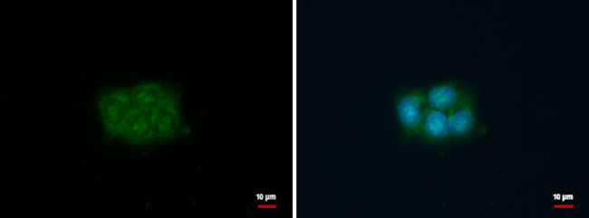 Fascin Antibody in Immunocytochemistry (ICC/IF)