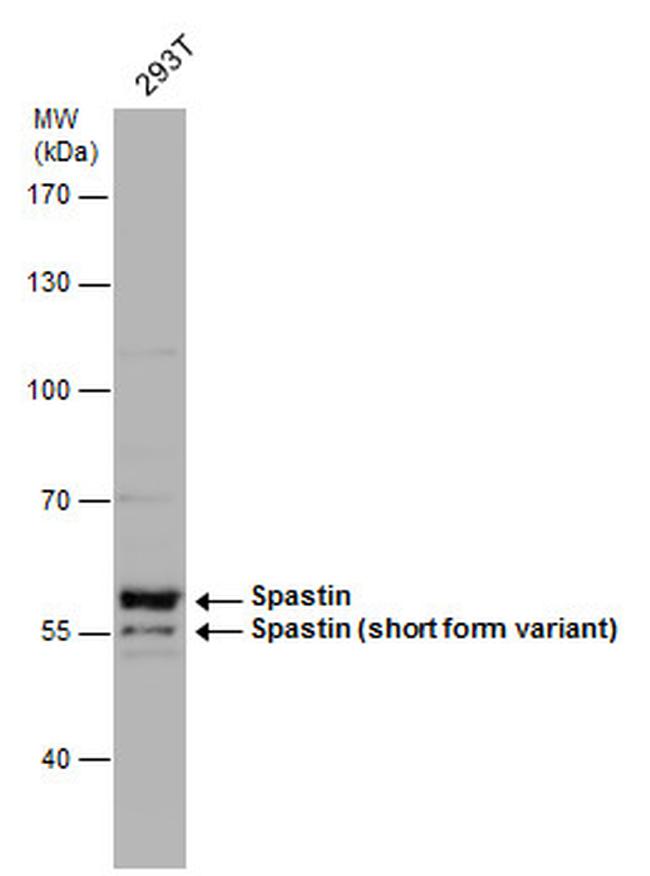Spastin Antibody in Western Blot (WB)