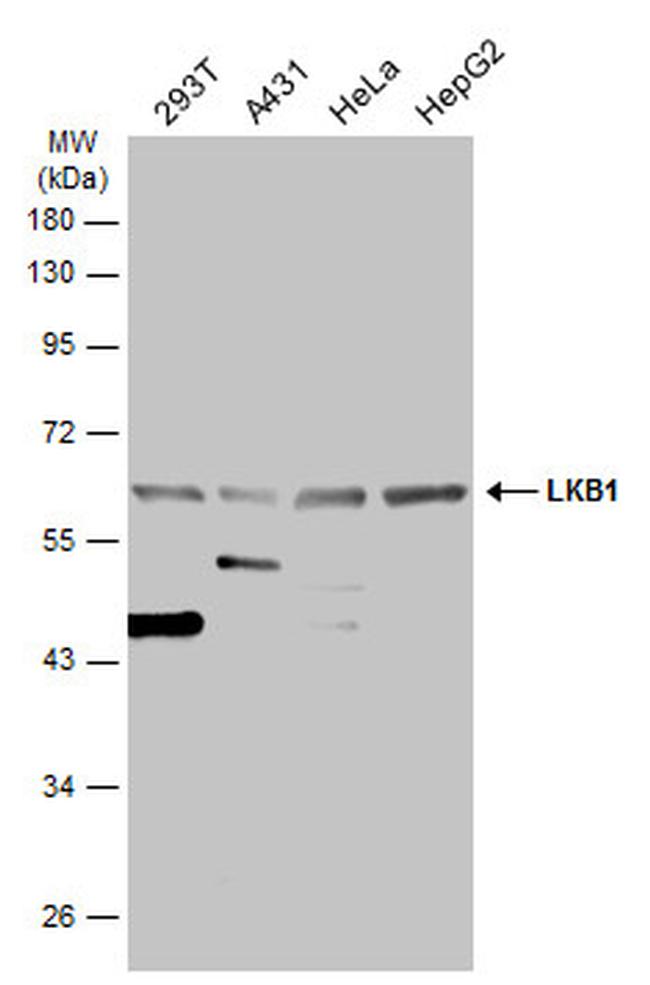 LKB1 Antibody in Western Blot (WB)