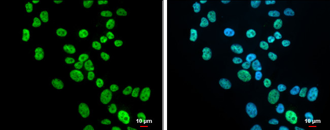 KHSRP Antibody in Immunocytochemistry (ICC/IF)