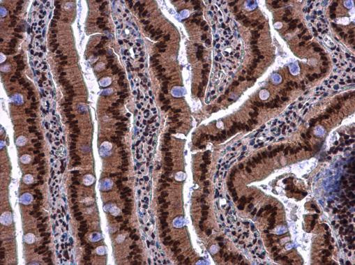 KHSRP Antibody in Immunohistochemistry (Paraffin) (IHC (P))