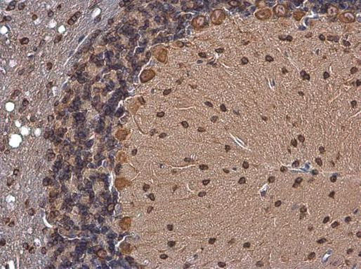 p35 Antibody in Immunohistochemistry (Paraffin) (IHC (P))