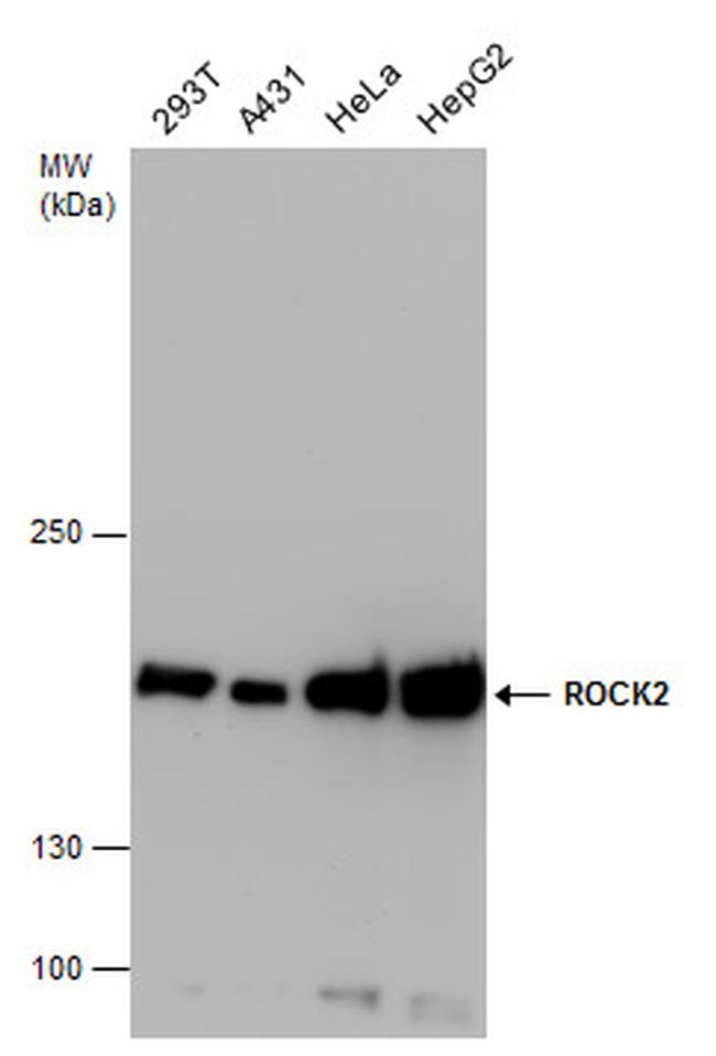 ROCK2 Antibody in Western Blot (WB)