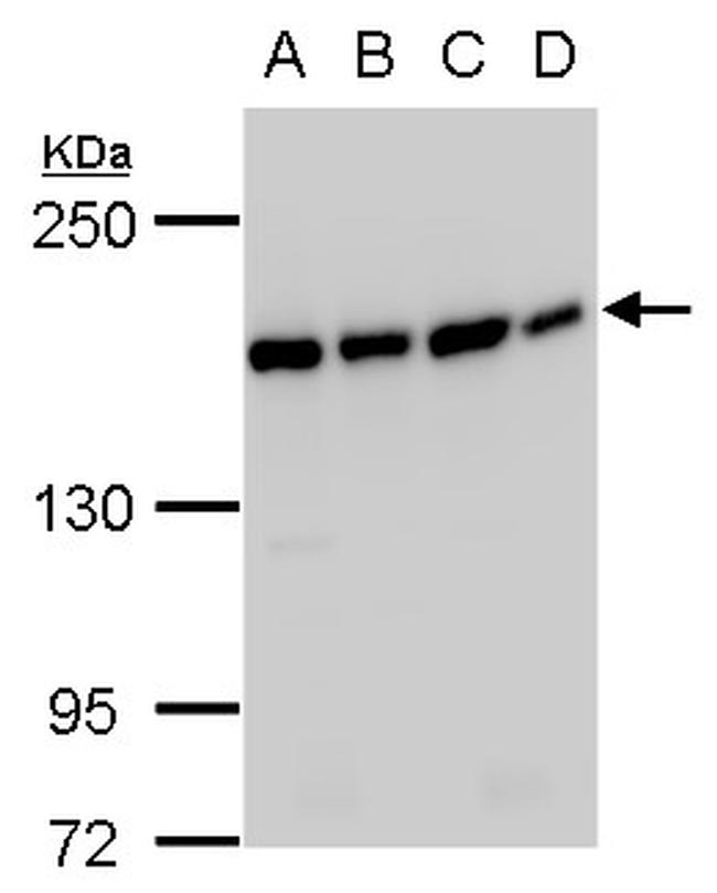 SMC4 Antibody in Western Blot (WB)