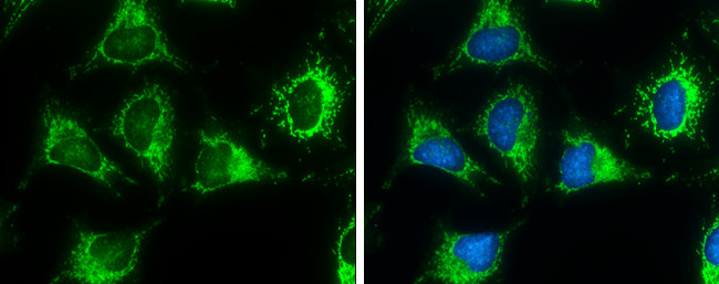 ACAA2 Antibody in Immunocytochemistry (ICC/IF)