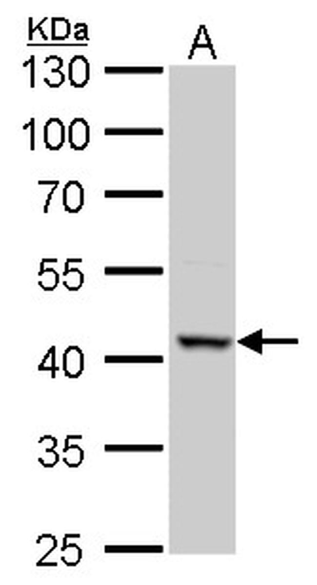 ACAA2 Antibody in Western Blot (WB)