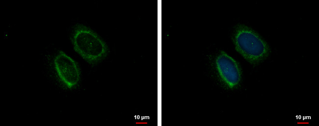 GABARAP Antibody in Immunocytochemistry (ICC/IF)