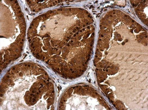 BTG1 Antibody in Immunohistochemistry (Paraffin) (IHC (P))