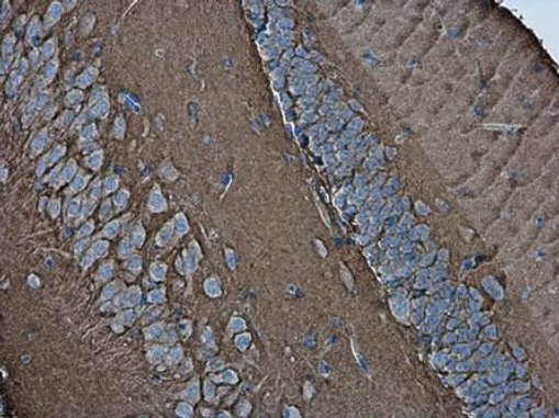 CD56 (NCAM) Antibody in Immunohistochemistry (Paraffin) (IHC (P))