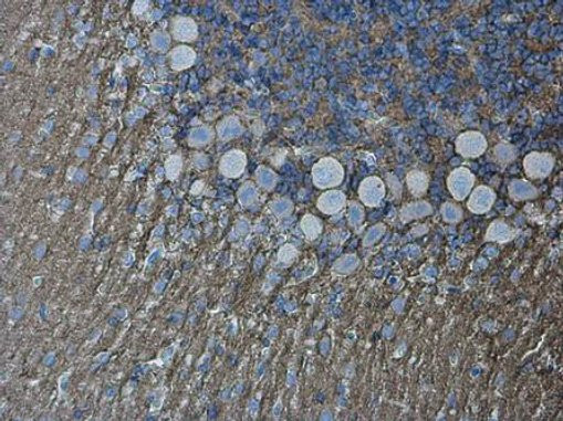 CD56 (NCAM) Antibody in Immunohistochemistry (Paraffin) (IHC (P))