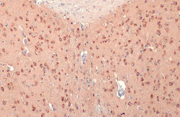 RASGRF1 Antibody in Immunohistochemistry (Paraffin) (IHC (P))