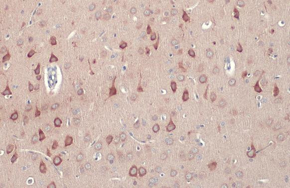 RASGRF1 Antibody in Immunohistochemistry (Paraffin) (IHC (P))