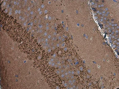 SH3GL1 Antibody in Immunohistochemistry (Paraffin) (IHC (P))