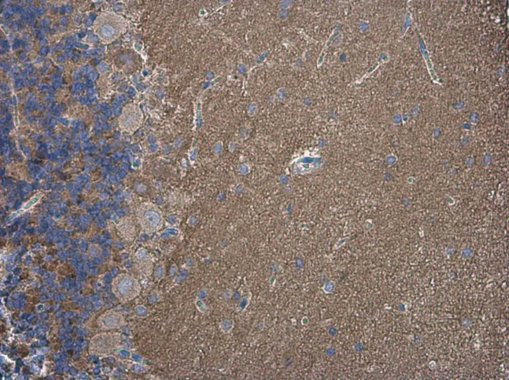 SH3GL1 Antibody in Immunohistochemistry (Paraffin) (IHC (P))