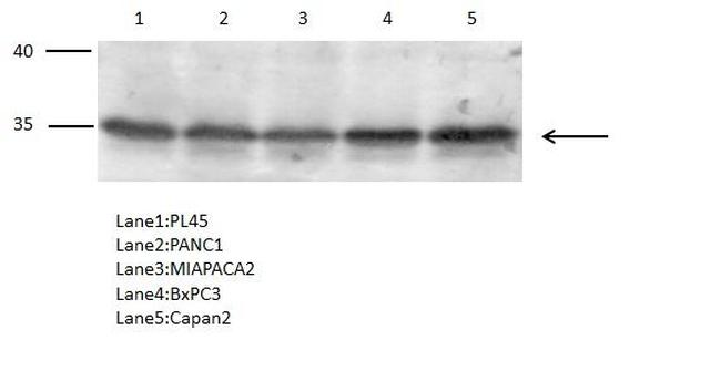 PTGR1 Antibody in Western Blot (WB)