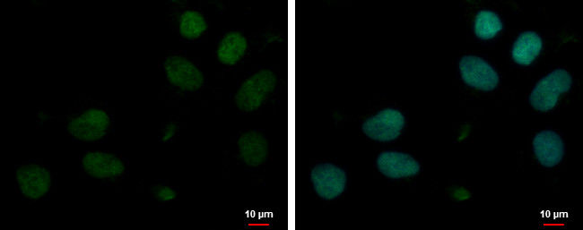 MYT1L Antibody in Immunocytochemistry (ICC/IF)