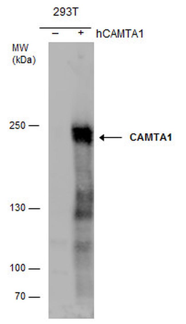 CAMTA1 Antibody in Western Blot (WB)