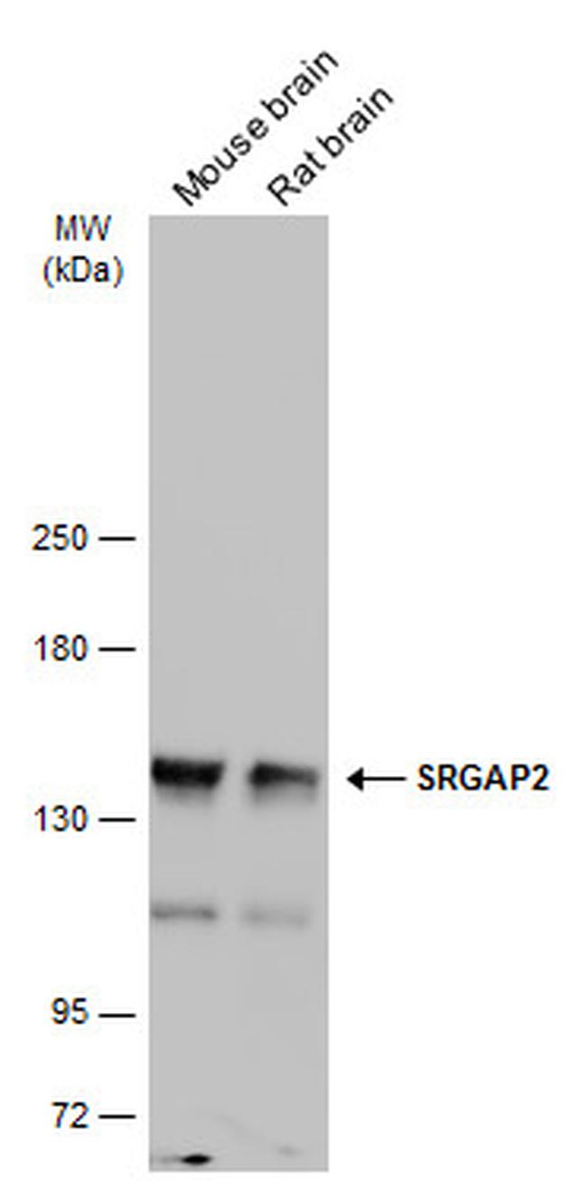 SRGAP2 Antibody in Western Blot (WB)