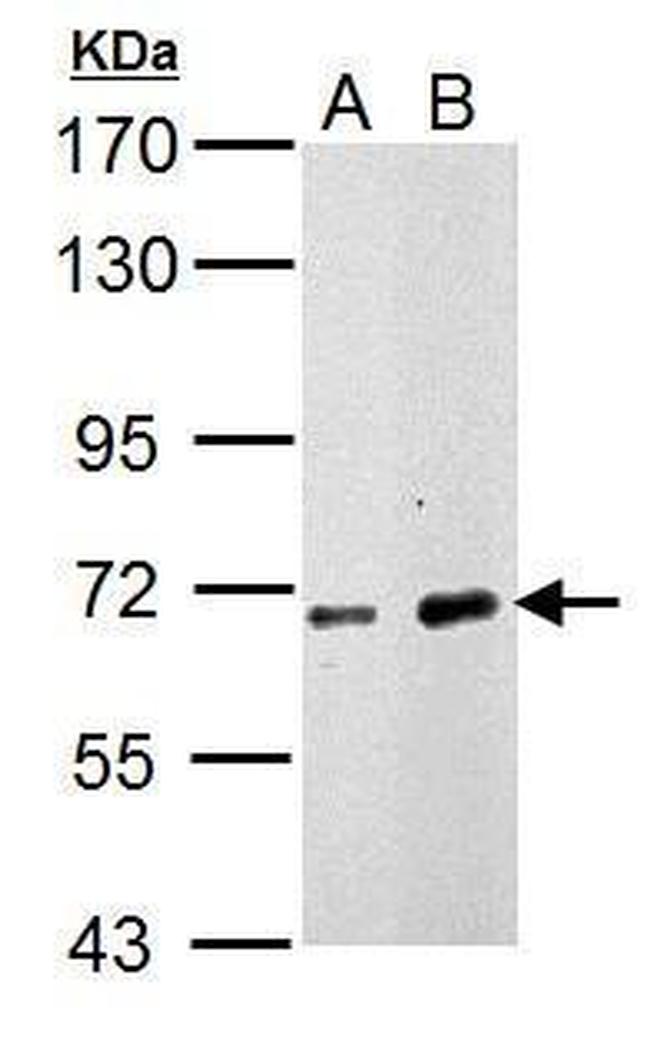 NUP62 Antibody in Western Blot (WB)