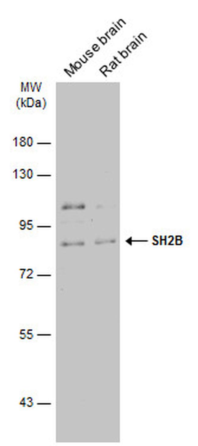 SH2B1 Antibody in Western Blot (WB)