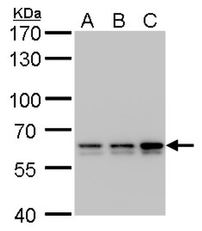PRPF31 Antibody in Western Blot (WB)