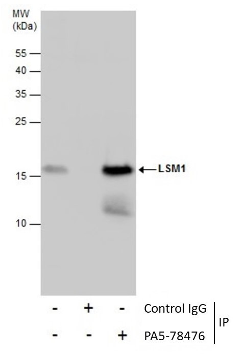 LSM1 Antibody in Immunoprecipitation (IP)