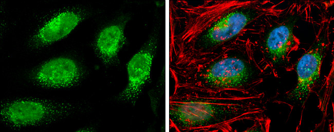 RIF1 Antibody in Immunocytochemistry (ICC/IF)