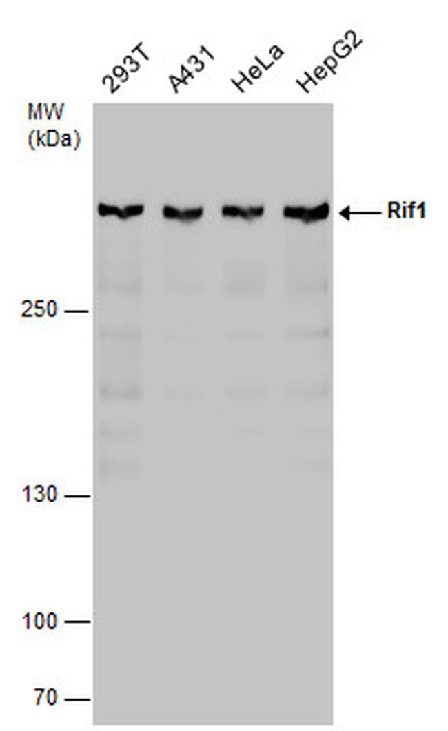 RIF1 Antibody in Western Blot (WB)