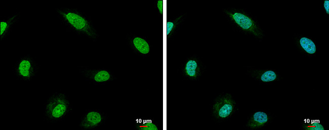 RIF1 Antibody in Immunocytochemistry (ICC/IF)