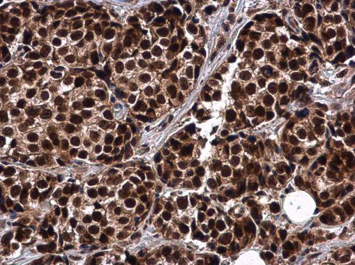 RIF1 Antibody in Immunohistochemistry (Paraffin) (IHC (P))