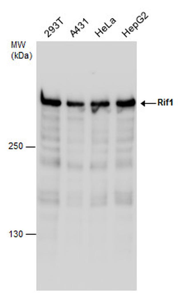 RIF1 Antibody in Western Blot (WB)