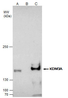 JMJD1A Antibody in Immunoprecipitation (IP)