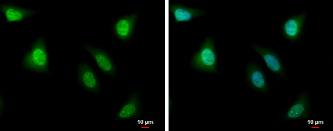 PBK Antibody in Immunocytochemistry (ICC/IF)