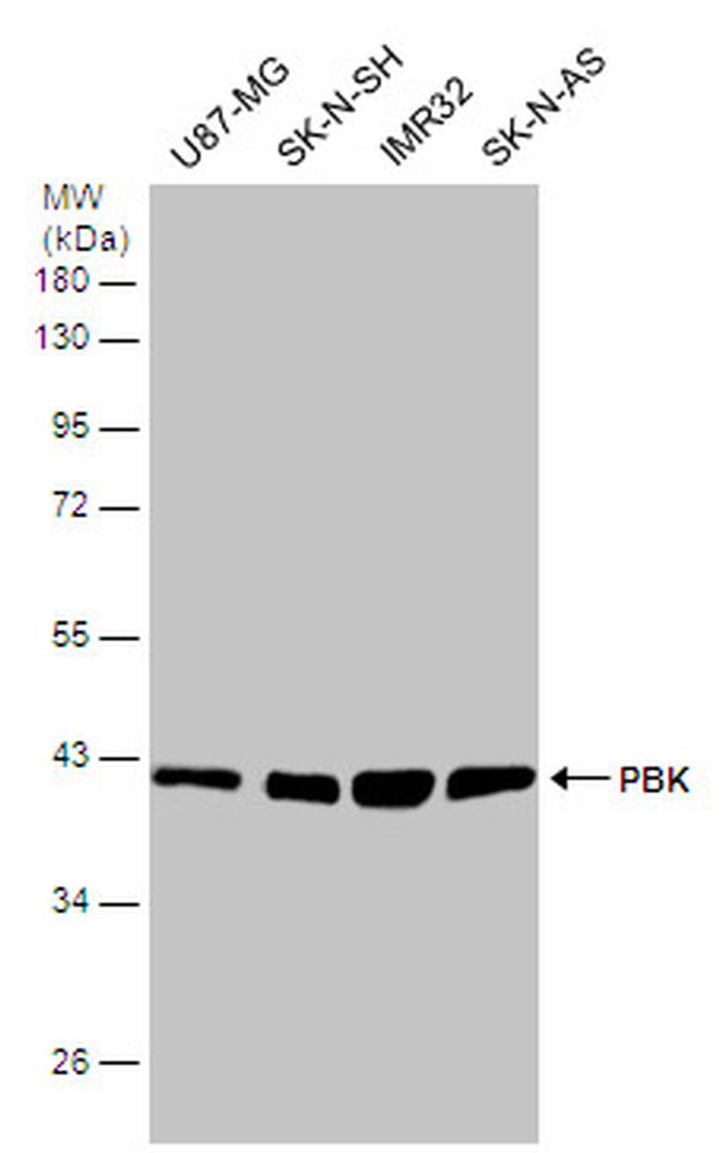 PBK Antibody in Western Blot (WB)