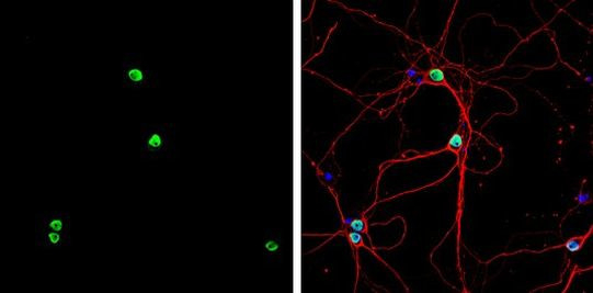 PTBP2 Antibody in Immunocytochemistry (ICC/IF)