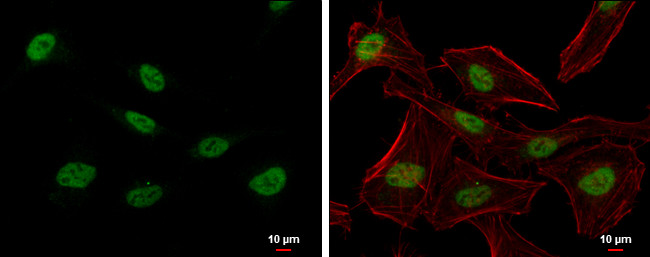 PTBP2 Antibody in Immunocytochemistry (ICC/IF)