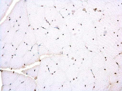 PTBP2 Antibody in Immunohistochemistry (Paraffin) (IHC (P))