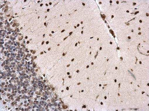 PTBP2 Antibody in Immunohistochemistry (Paraffin) (IHC (P))