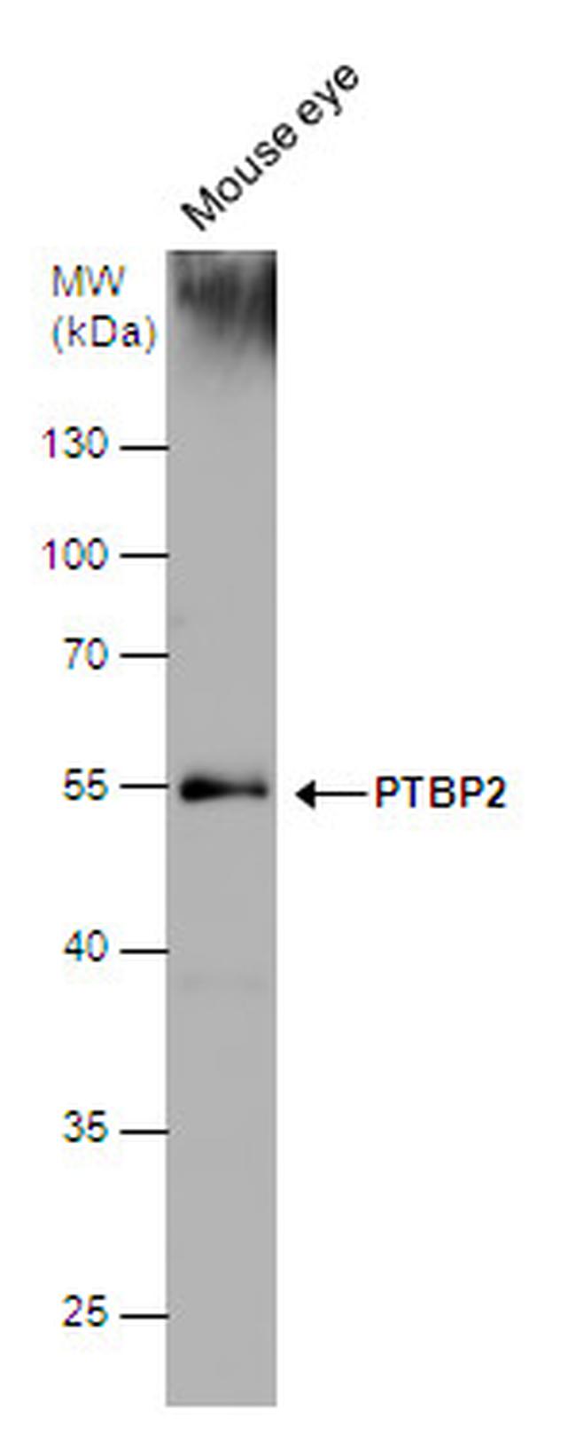 PTBP2 Antibody in Western Blot (WB)