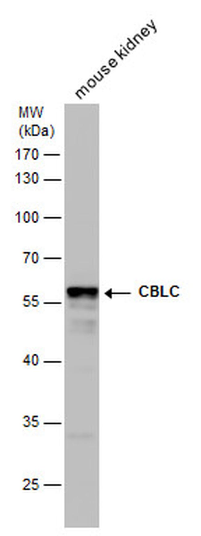 CBLC Antibody in Western Blot (WB)