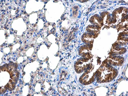 DOCK8 Antibody in Immunohistochemistry (Paraffin) (IHC (P))