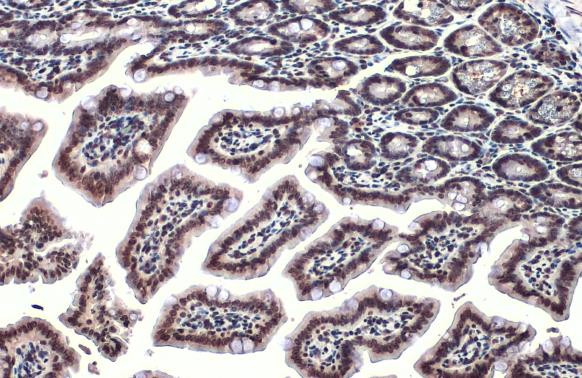 ARID5B Antibody in Immunohistochemistry (Paraffin) (IHC (P))