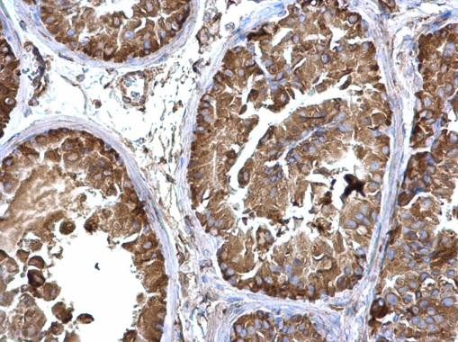 LZTR2 Antibody in Immunohistochemistry (Paraffin) (IHC (P))