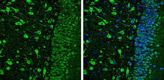 NRG1 Antibody in Immunohistochemistry (Paraffin) (IHC (P))