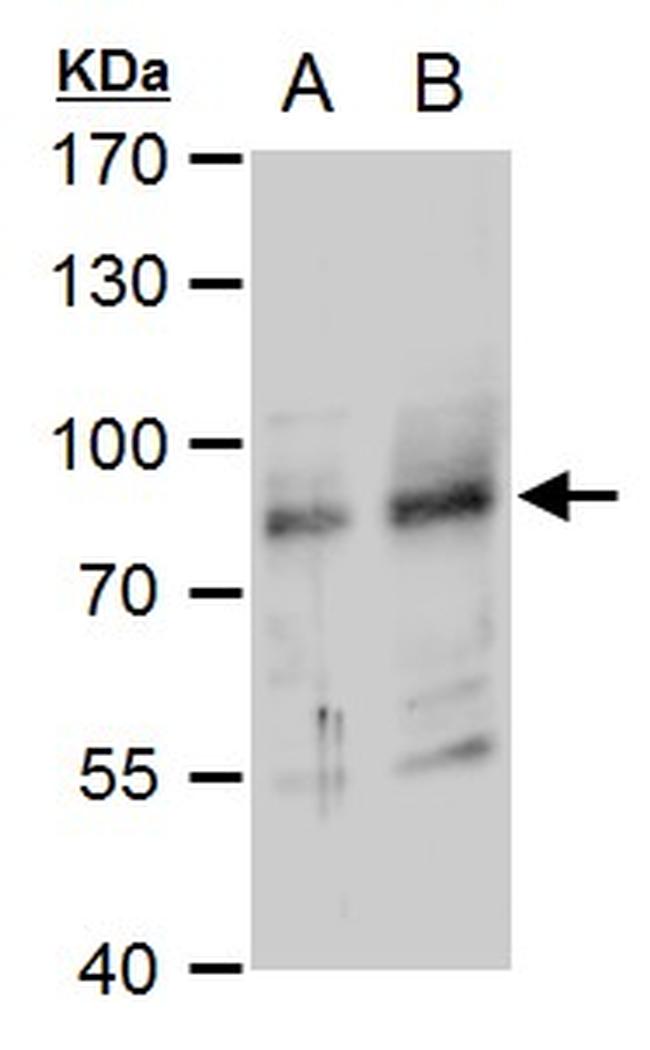 RNF168 Antibody in Western Blot (WB)